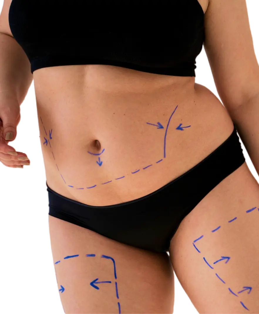 top tummy tuck surgeon